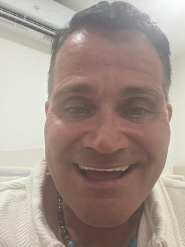 Close-up of a customer's happy smile, showcasing his Pop On Veneers.