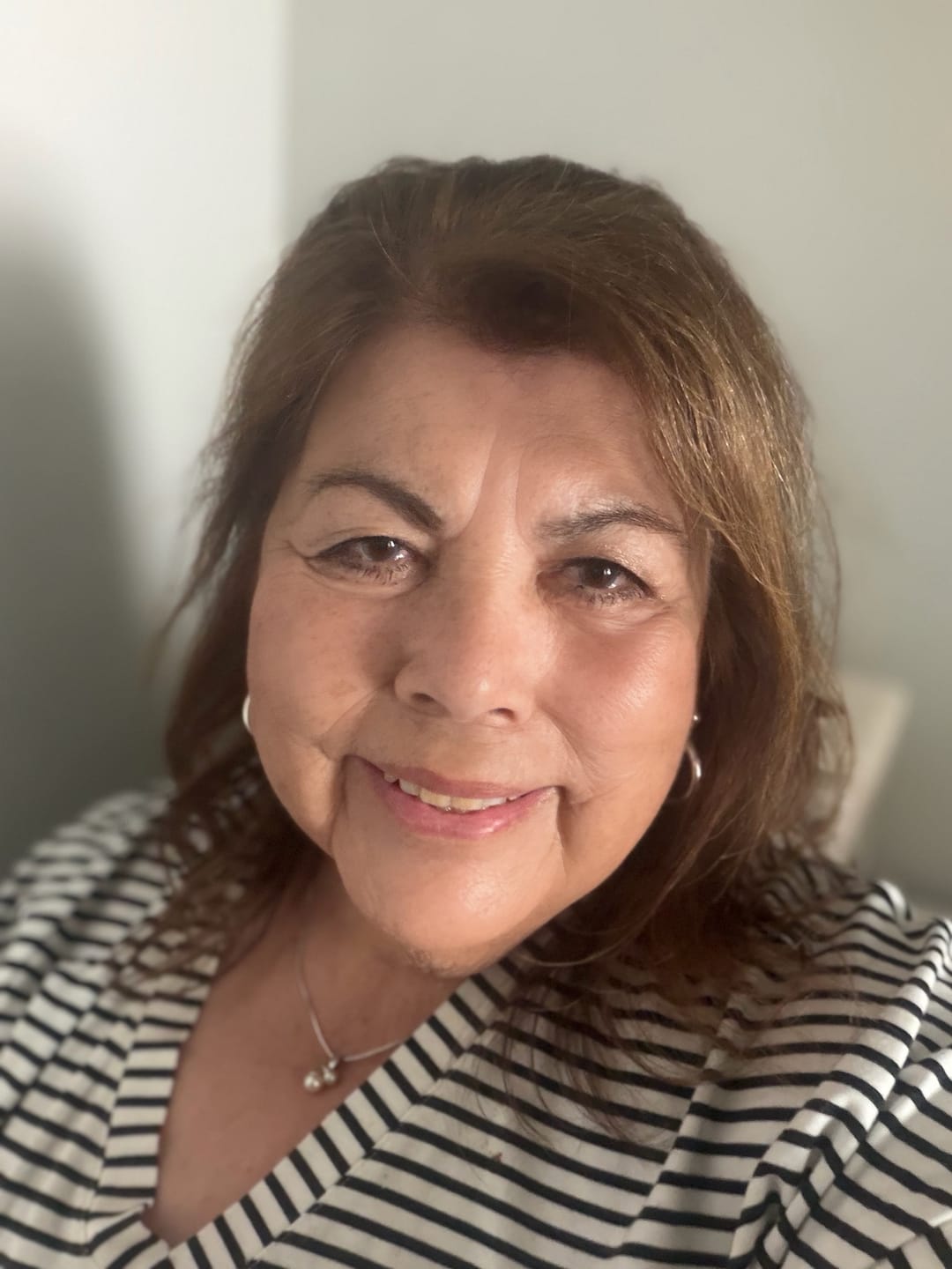 Customer photo review of Koriderm™ Time Reverse Cream (All-In-One)