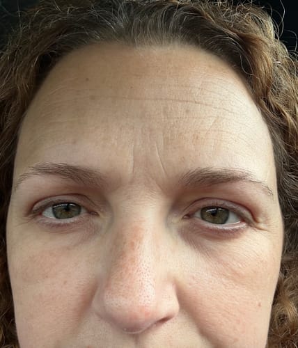 Customer photo review of Seb Natural Calming Serum