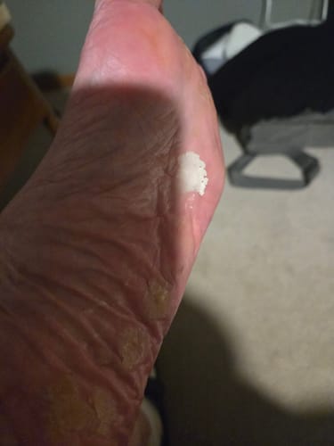 Customer photo review of Pure - Unscented Tallow + Jojoba Balm