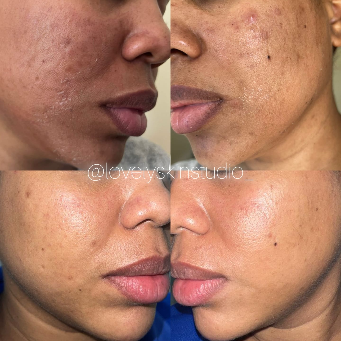 Customer photo review of Zena 100% Organic Algae Peel