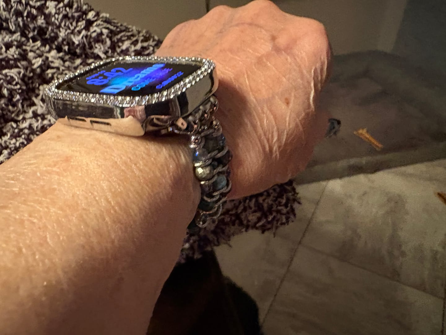 Customer photo review of Apatite Azure Braided Apple Watch Strap