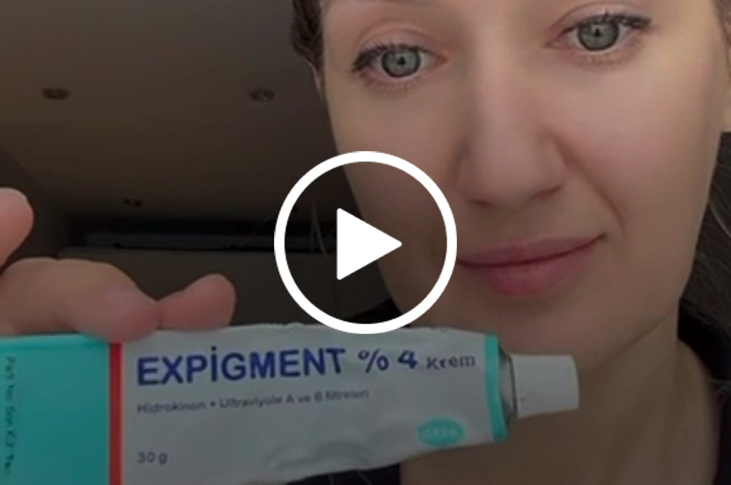 Customer video review of EXPIGMENT %4 Cream 30 gr