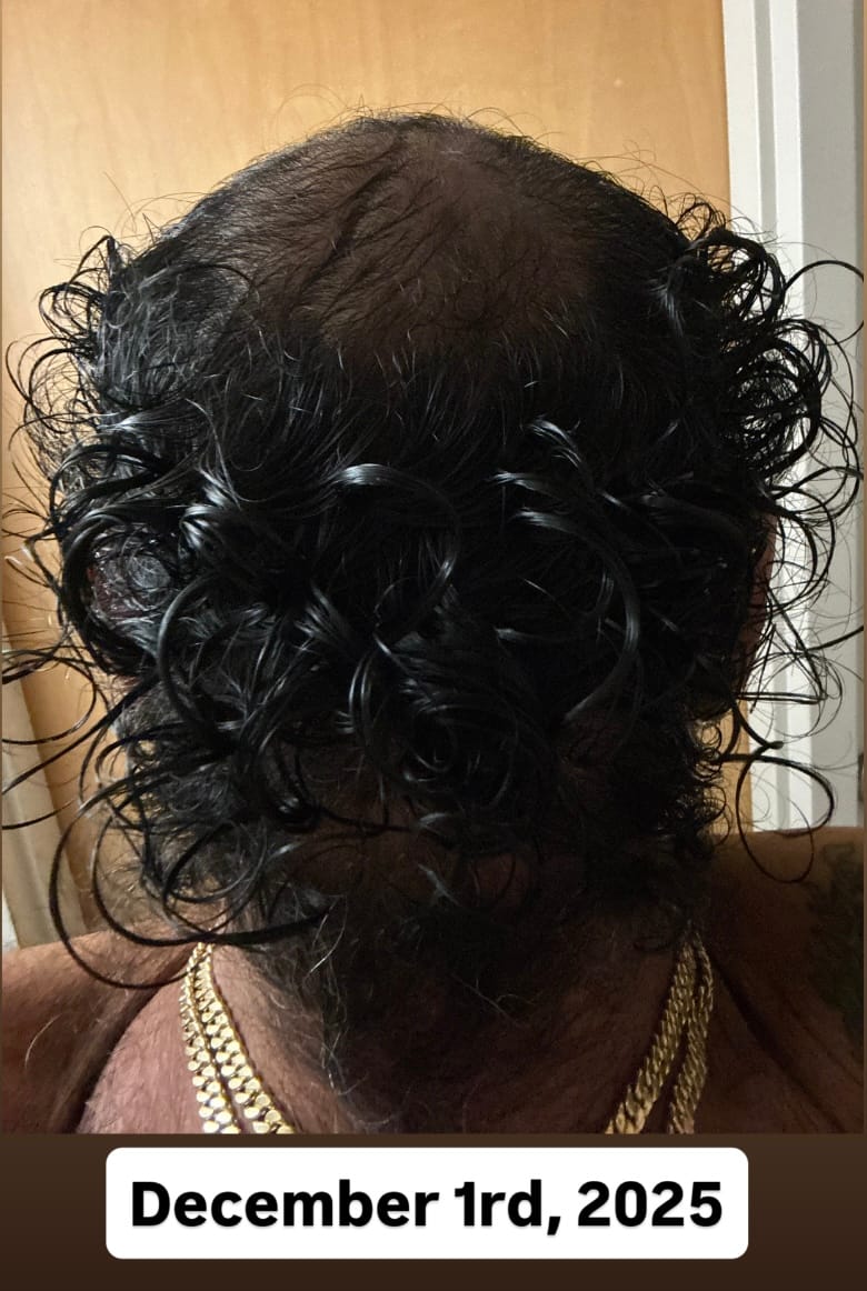 Customer photo review of SPARTAN™ - Root Activator Spray