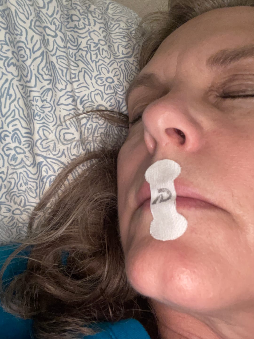 Customer photo review of Dream Mouth Tape Strips