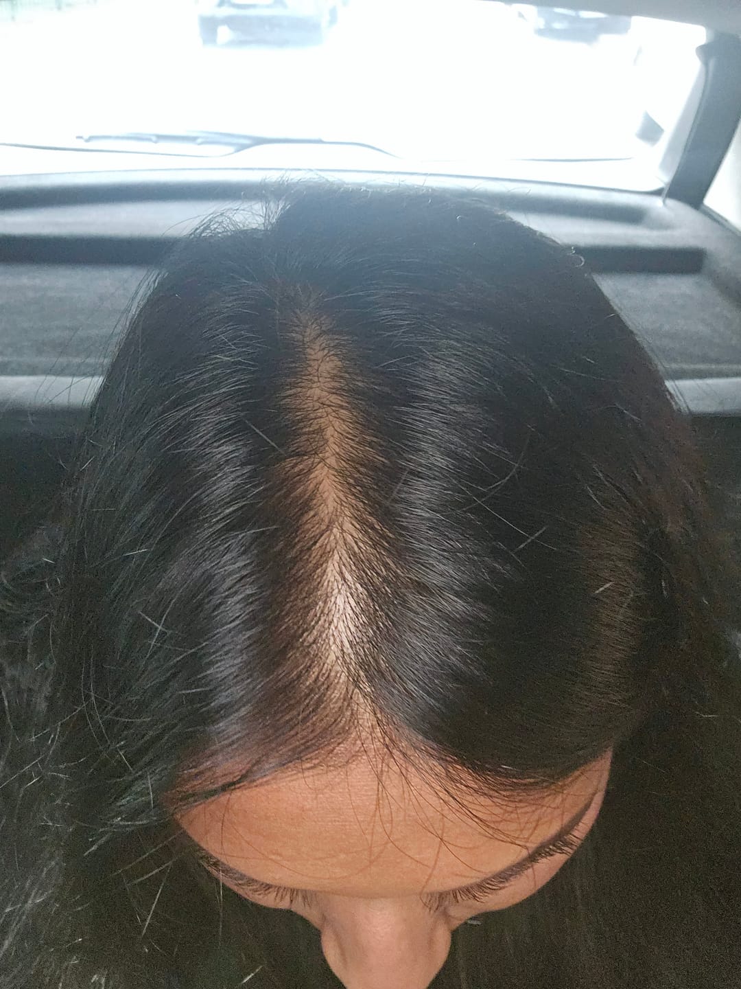 Customer photo review of VITAFOAM ™ Hair Growth Formula