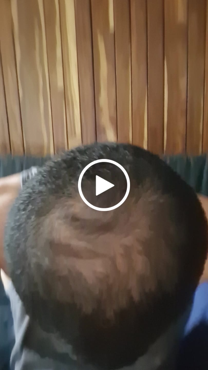 Customer video review of Dutasterida 0.5 mg con 90 tabletas tratamiento para 90 dias