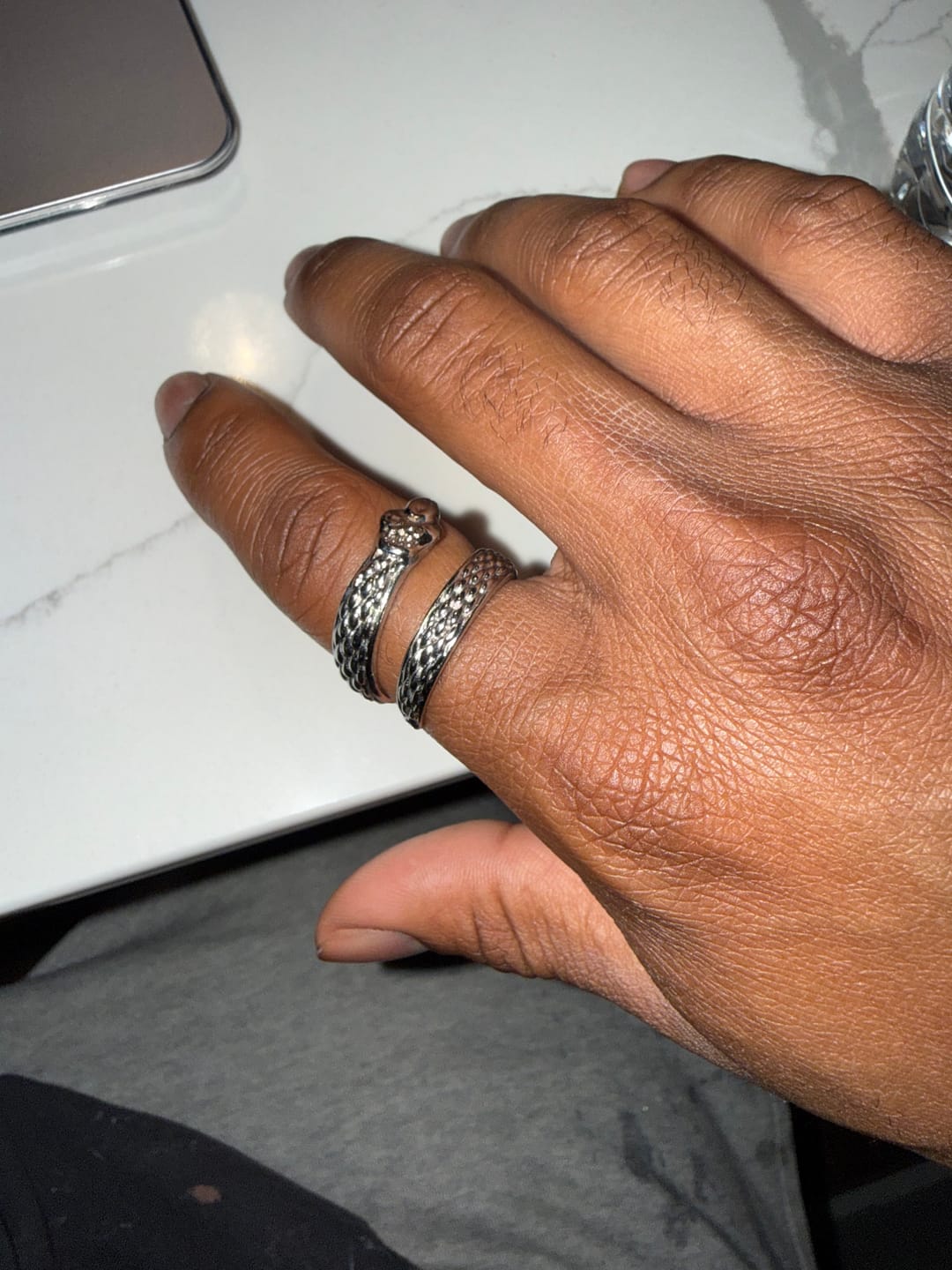 Customer photo review of UPGRADED SLIME RING