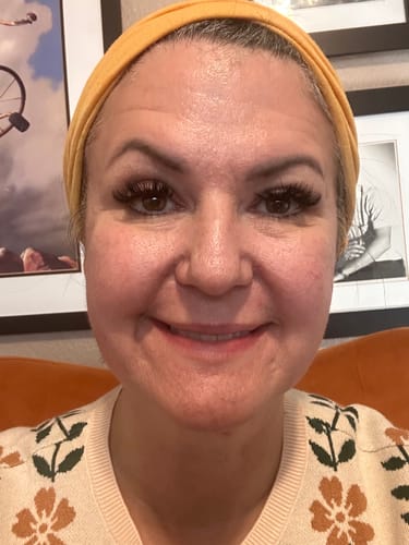 Close-up of the reviewer's face after using the Seranova Microneedling Infusion System.
