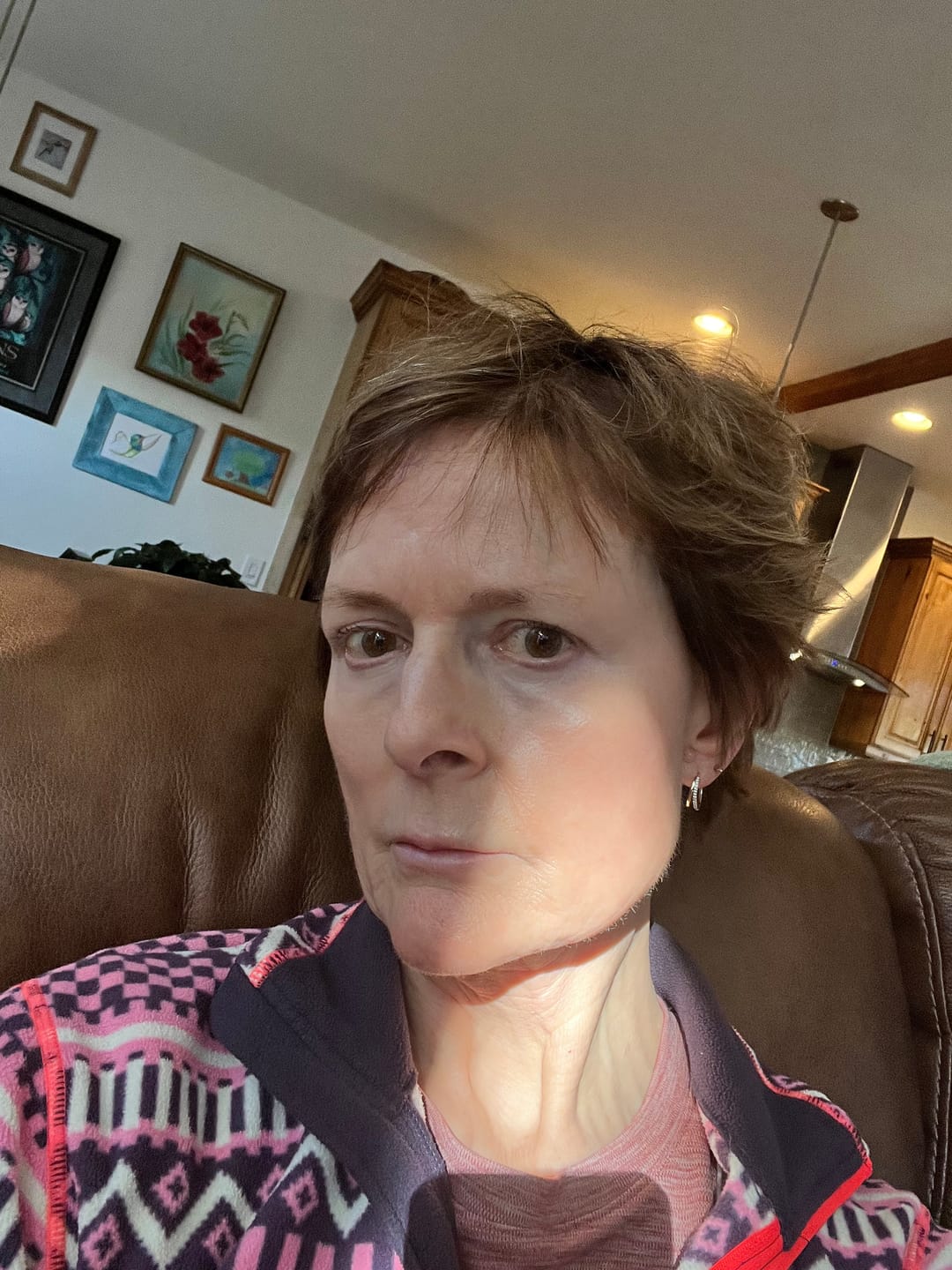 Customer photo review of Anti-Aging treatment