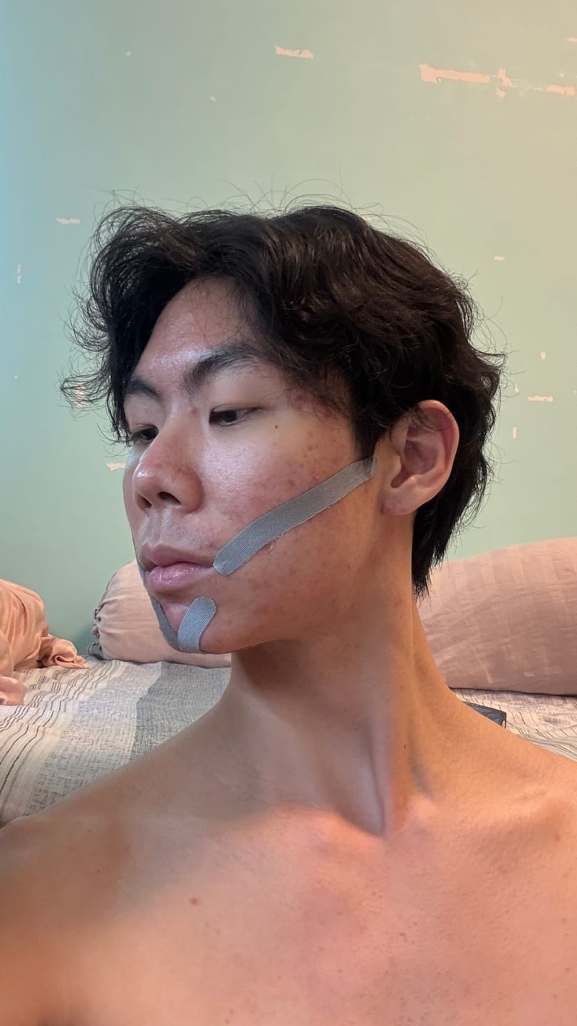 Customer photo review of Zygo Tape - Facial Sculpting & Anti-Aging Tape