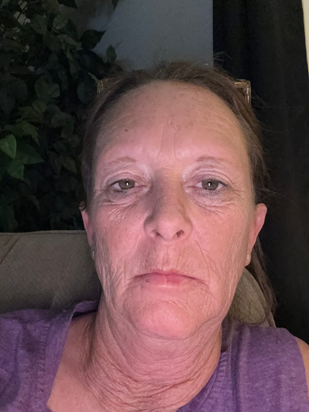 Customer photo review of Glov Micro Infusion System