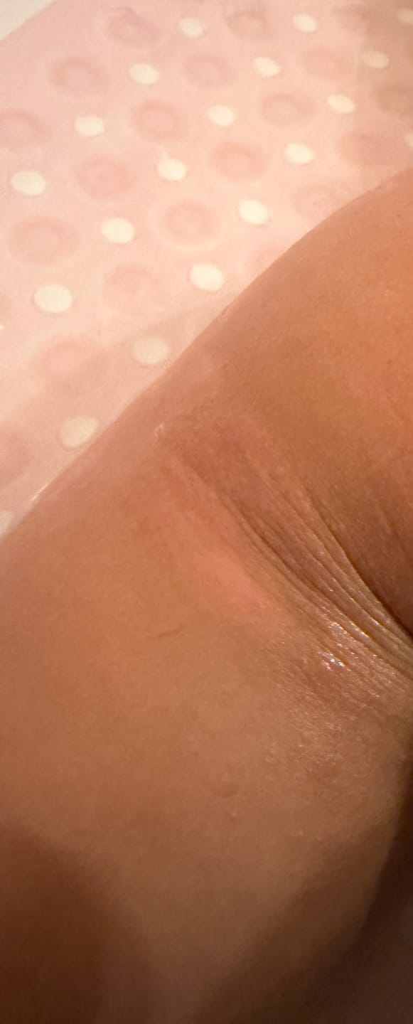 Customer photo review of Skin Rescue Set Hemp & Calendula