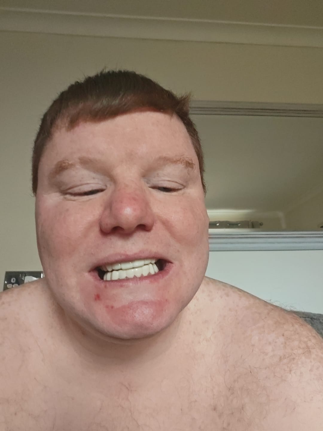 Customer photo review of Click-in Veneers 4.0