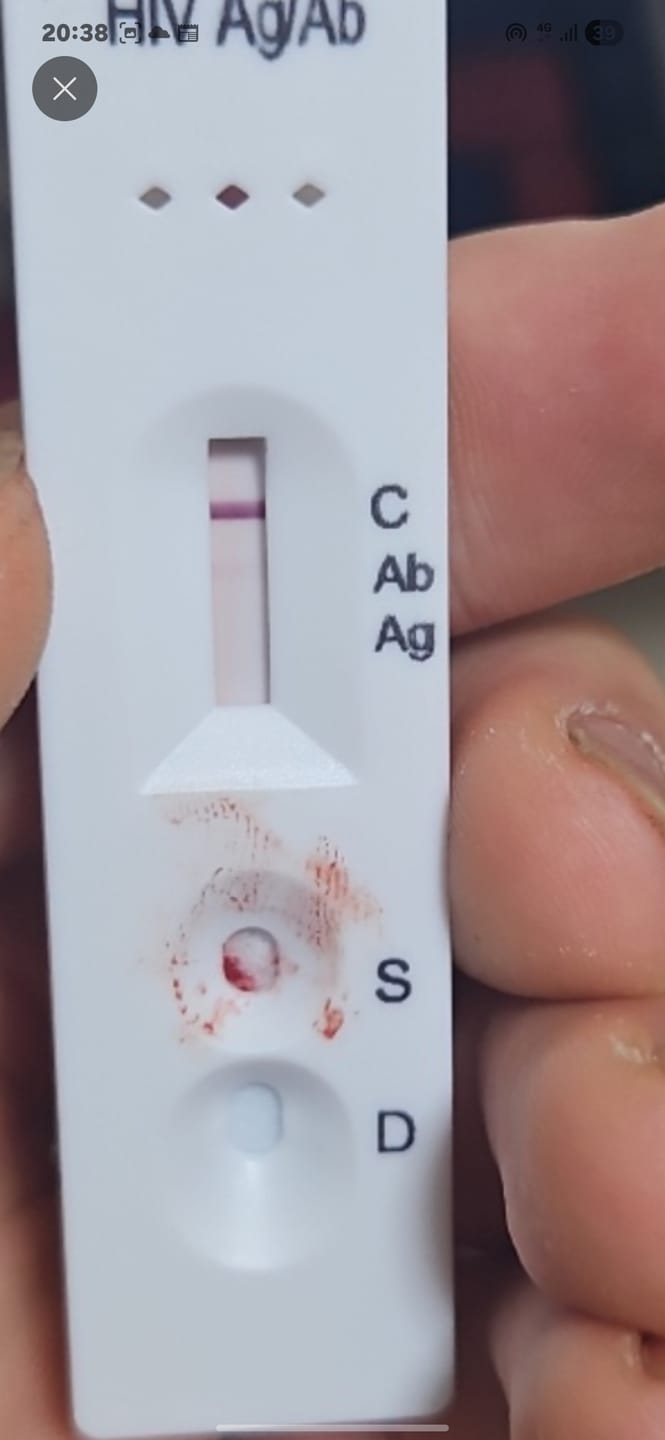 Customer photo review of STD自宅検査｜HIV(エイズ) 検査キット