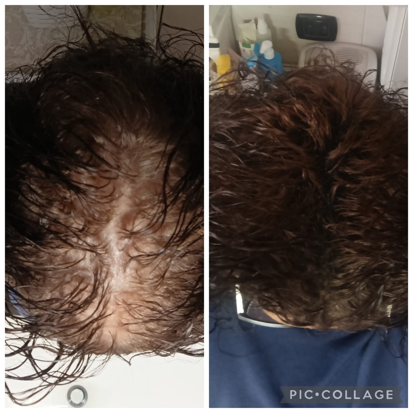 Customer photo review of Fibre copri Calvizie da 12gr  | Castano Scuro | 30 Giorni di applicazioni