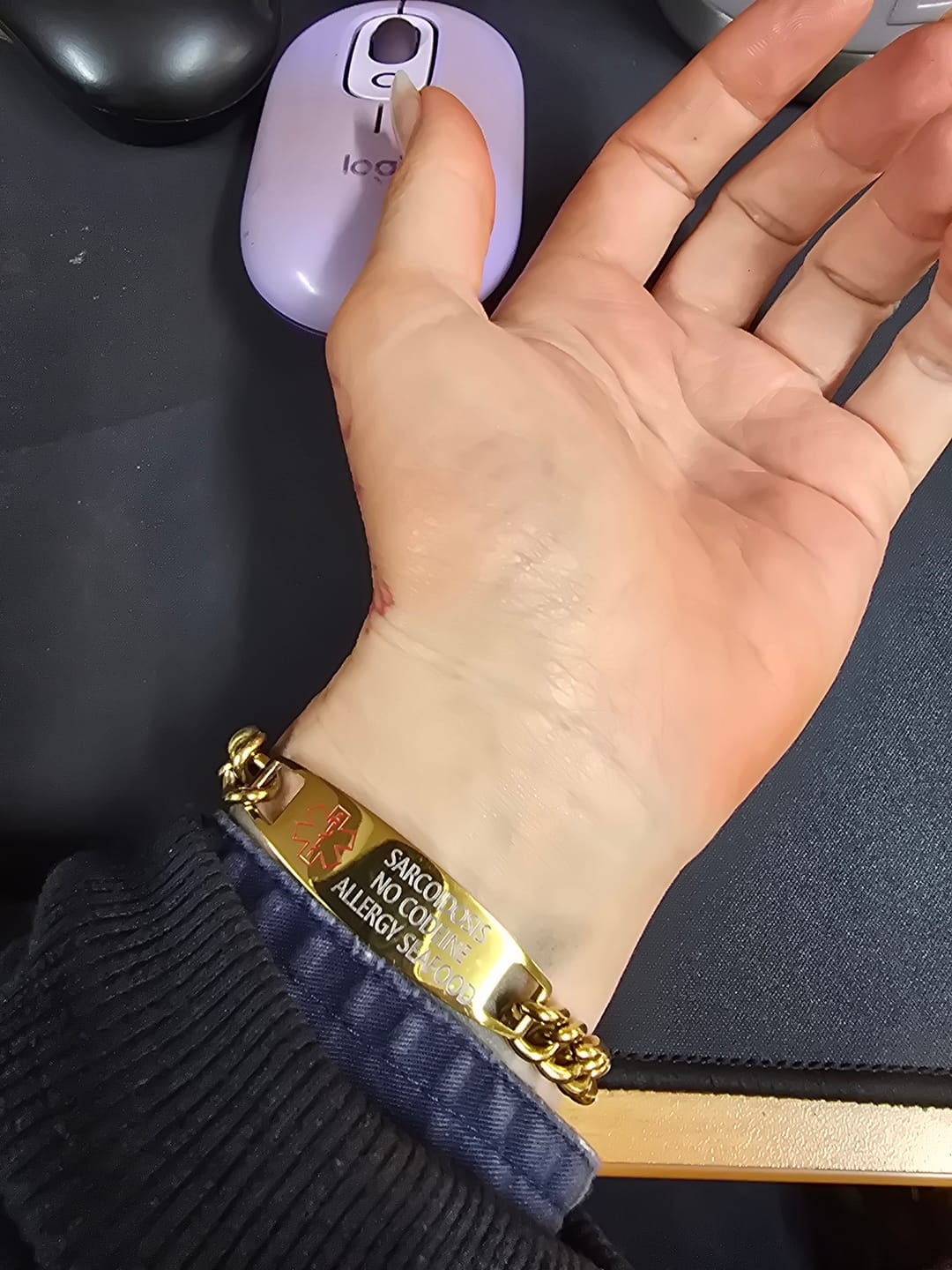 Customer photo review of Personalised Gold Colour Medical Alert Chain Bracelet