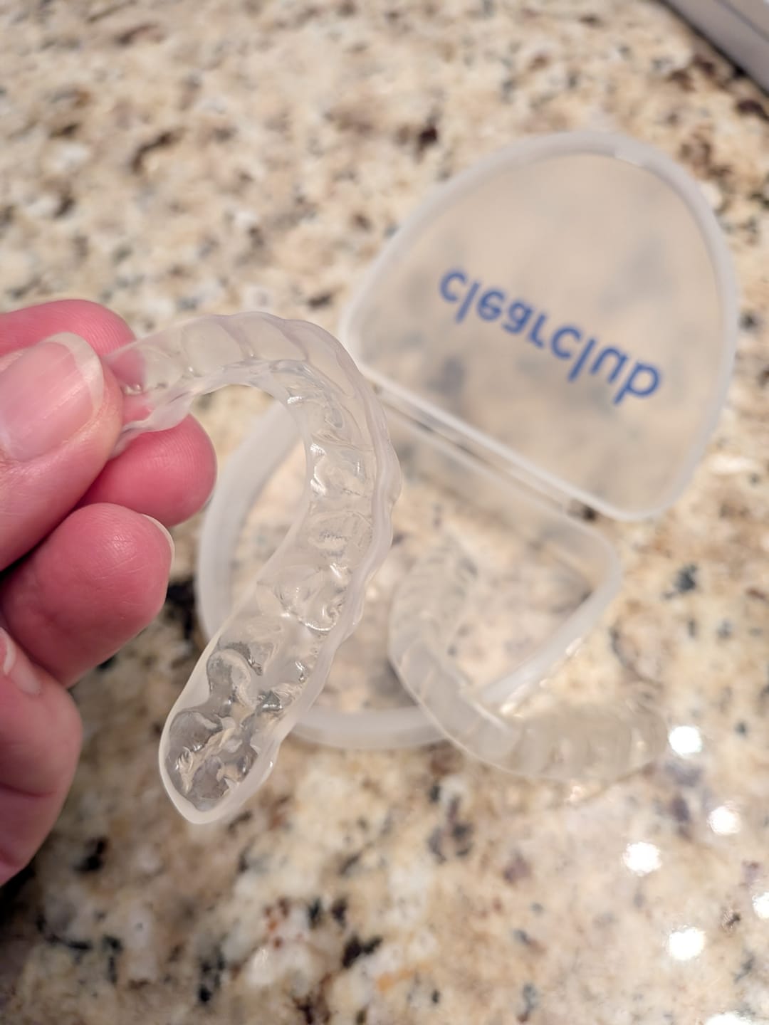 Customer photo review of Clear Custom Night Guard