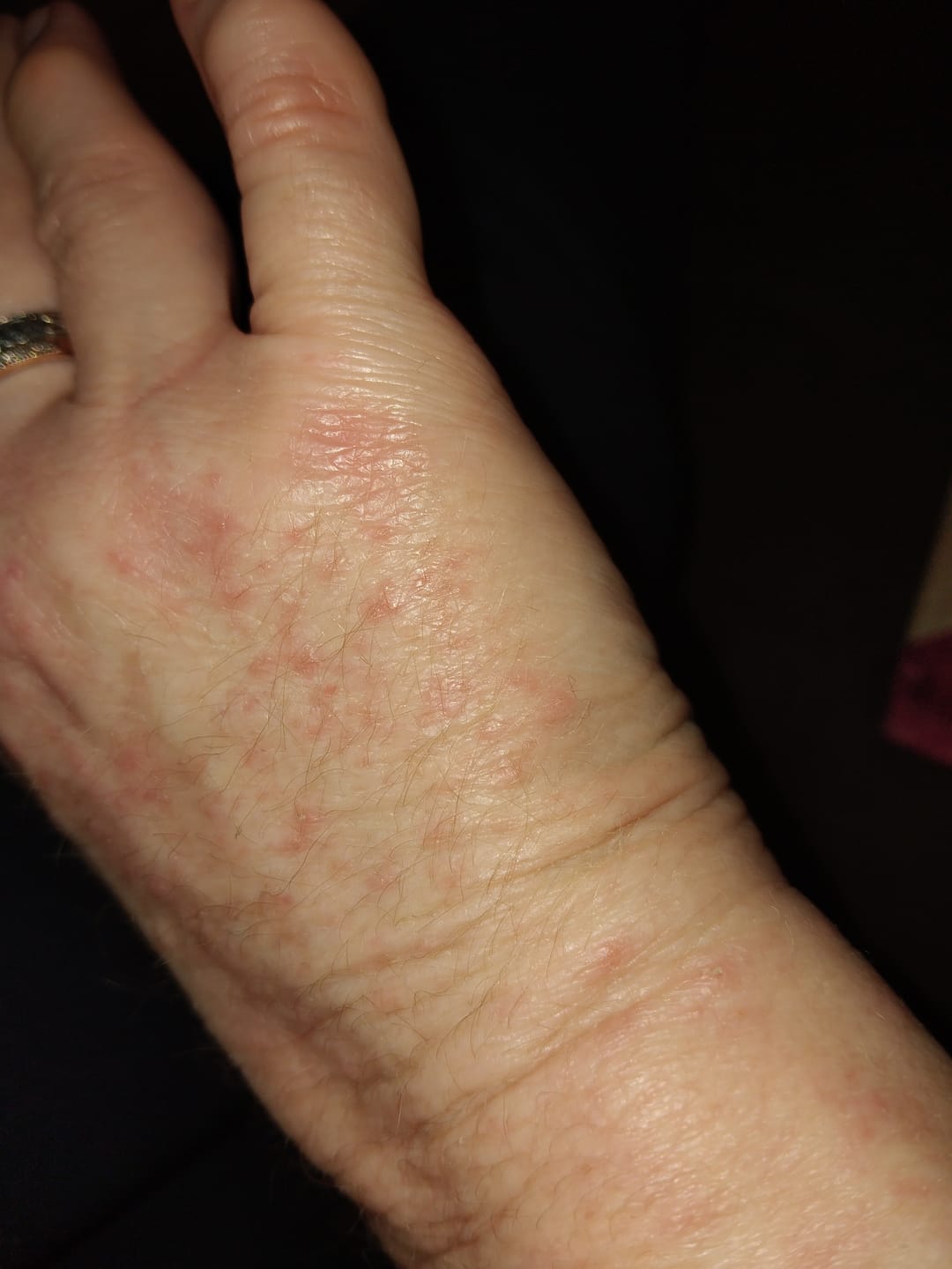 Customer photo review of Instant Softening Hand Balm