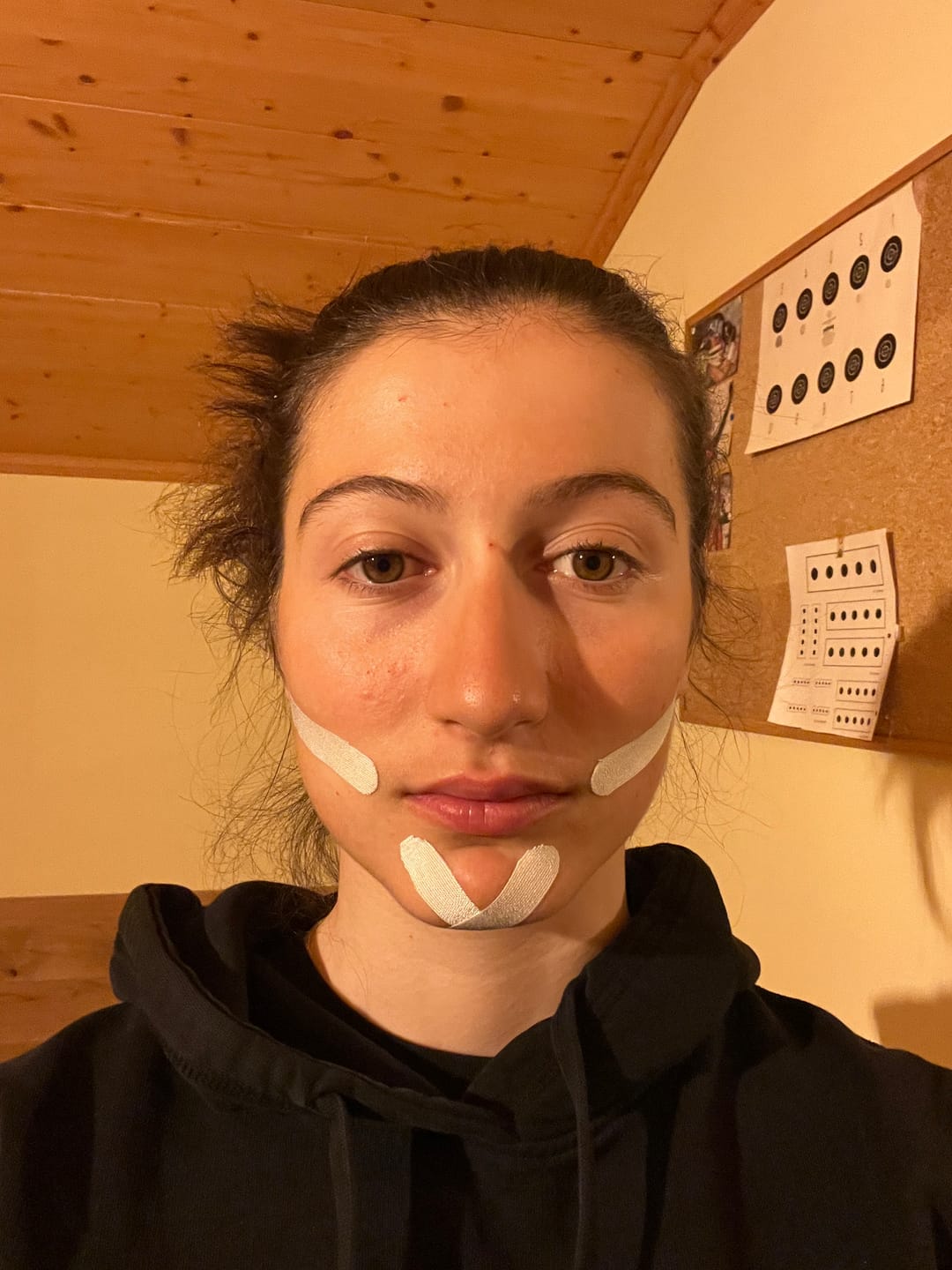 Customer photo review of Zygo Tape - Facial Sculpting & Anti-Aging Tape For Women