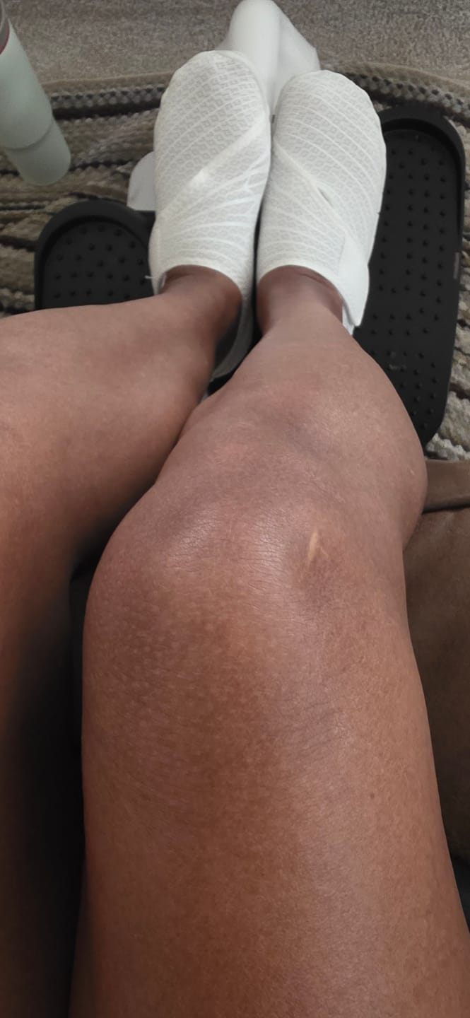 Customer photo review of CloudEase Insole