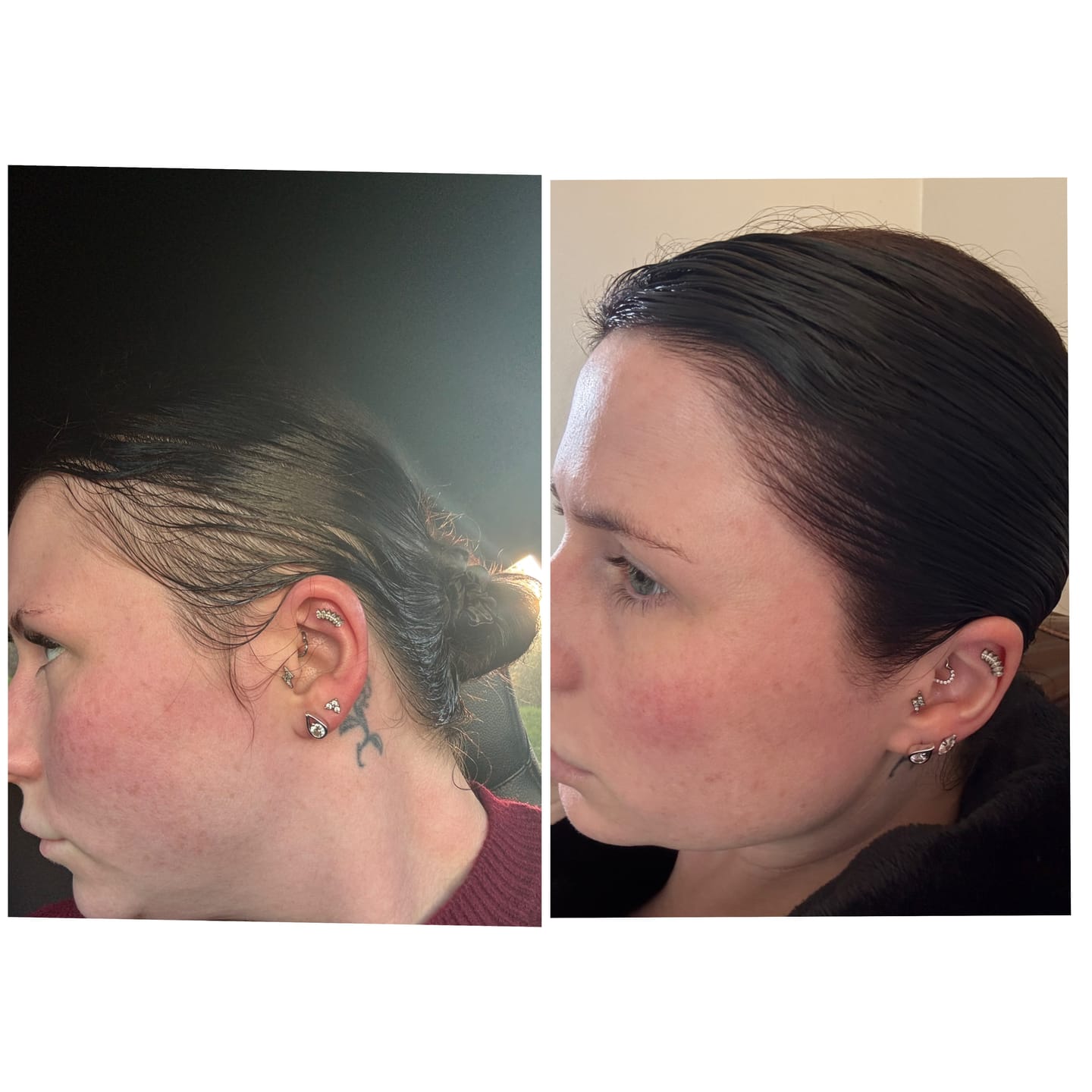 Customer photo review of VITAFOAM ™ Hair Growth Formula