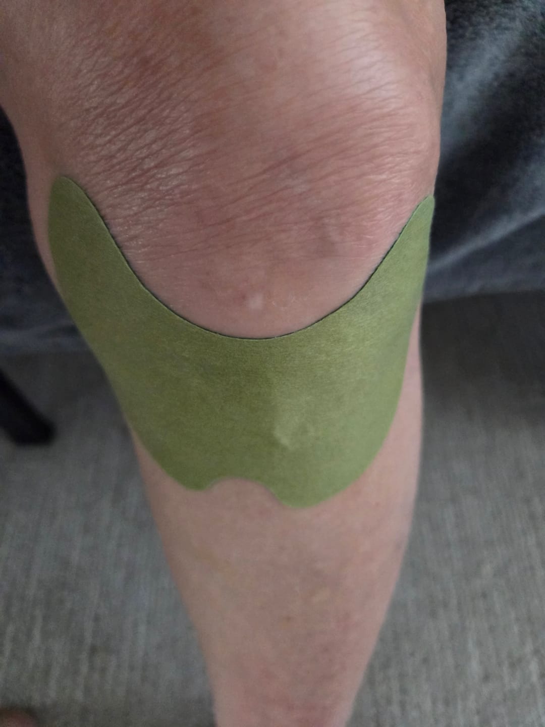 Customer photo review of Auxilium Knee Patch (fka Heaven Patch)