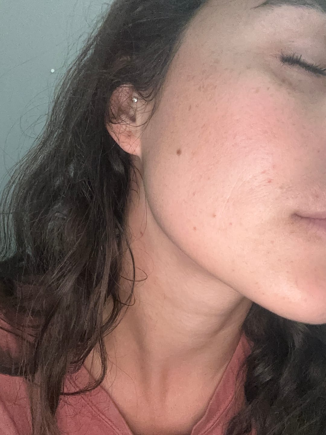 Customer photo review of Clove Skincare Collection – Full Set