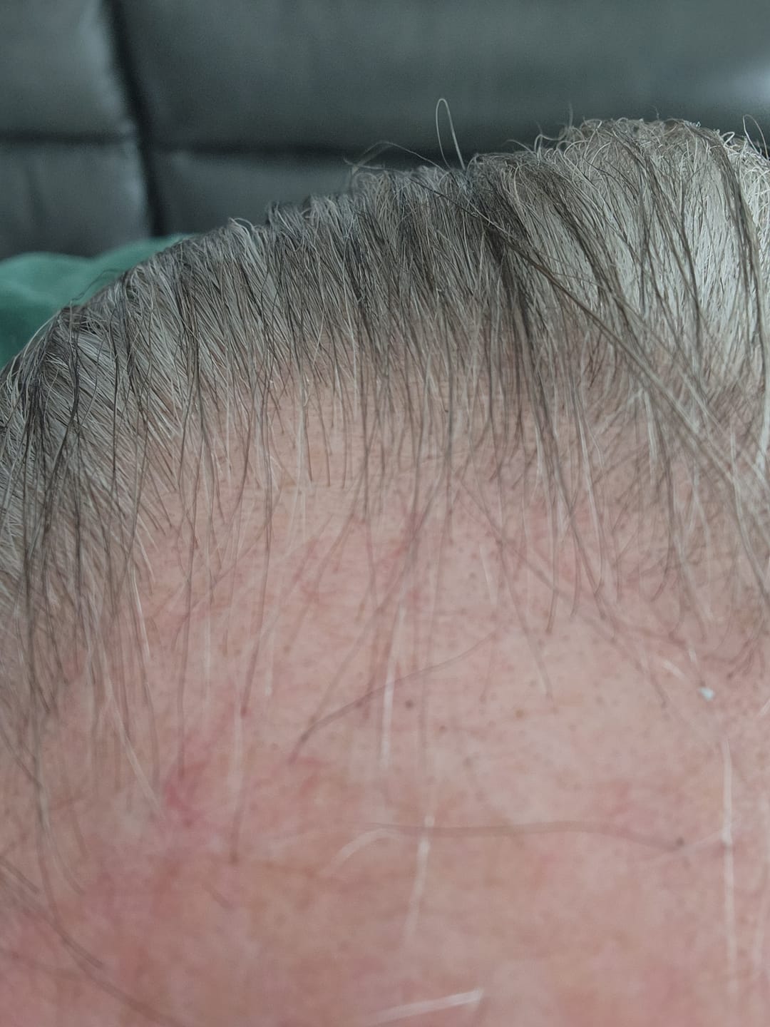 Customer photo review of SHAMPOING NATUREL AU ROMARIN ET À LA KÉRATINE — POUR DES CHEVEUX PLUS ÉPAIS ET PLUS VOLUMINEUX