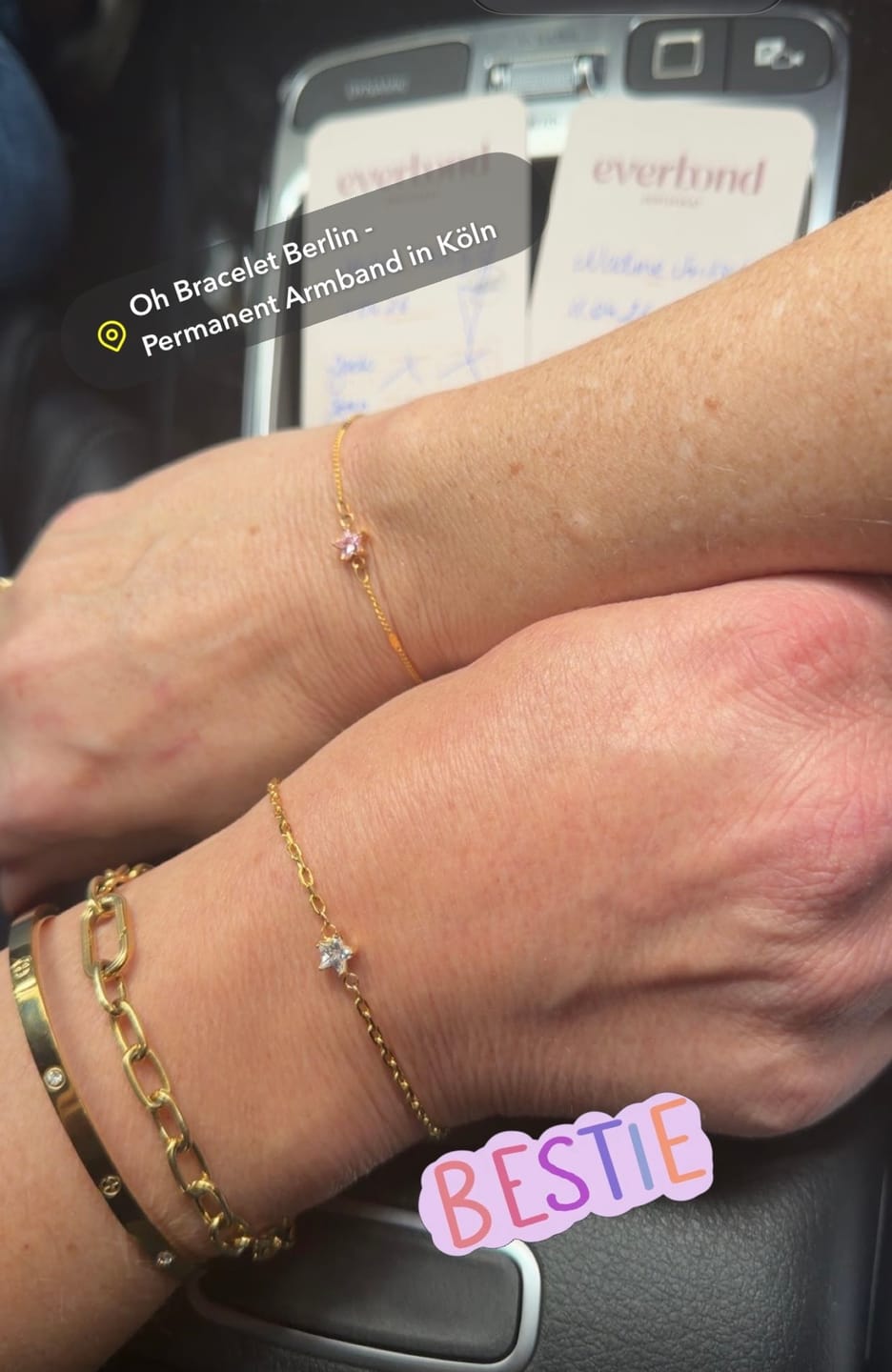 Customer photo review of Permanent Armband - dein everbond in Köln