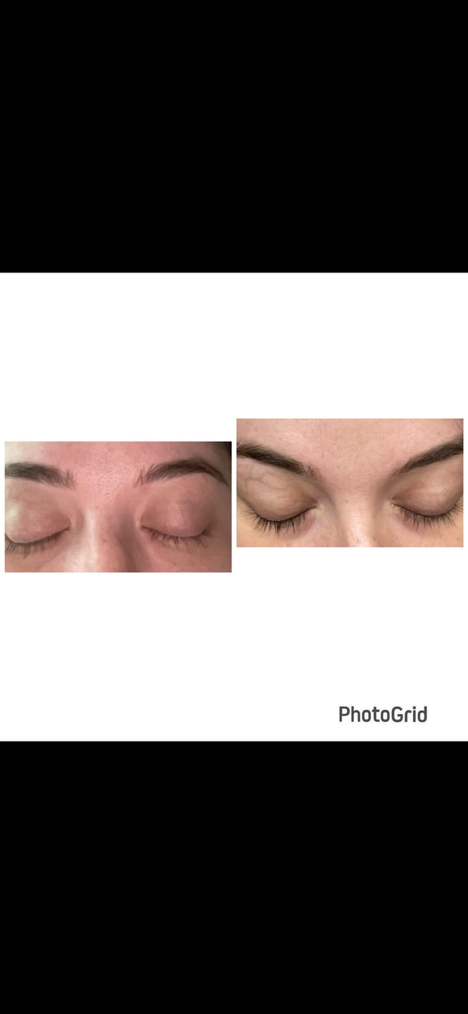 Customer photo review of Volume Eyebrow and Eyelash Serum -