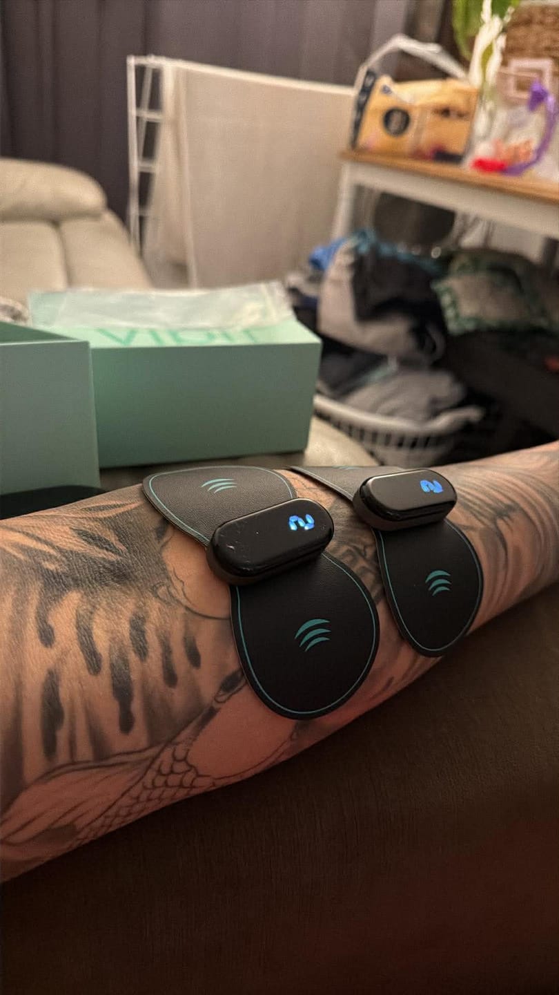 Customer photo review of Vibit TENS - Electrical Nerve Stimulation Therapy