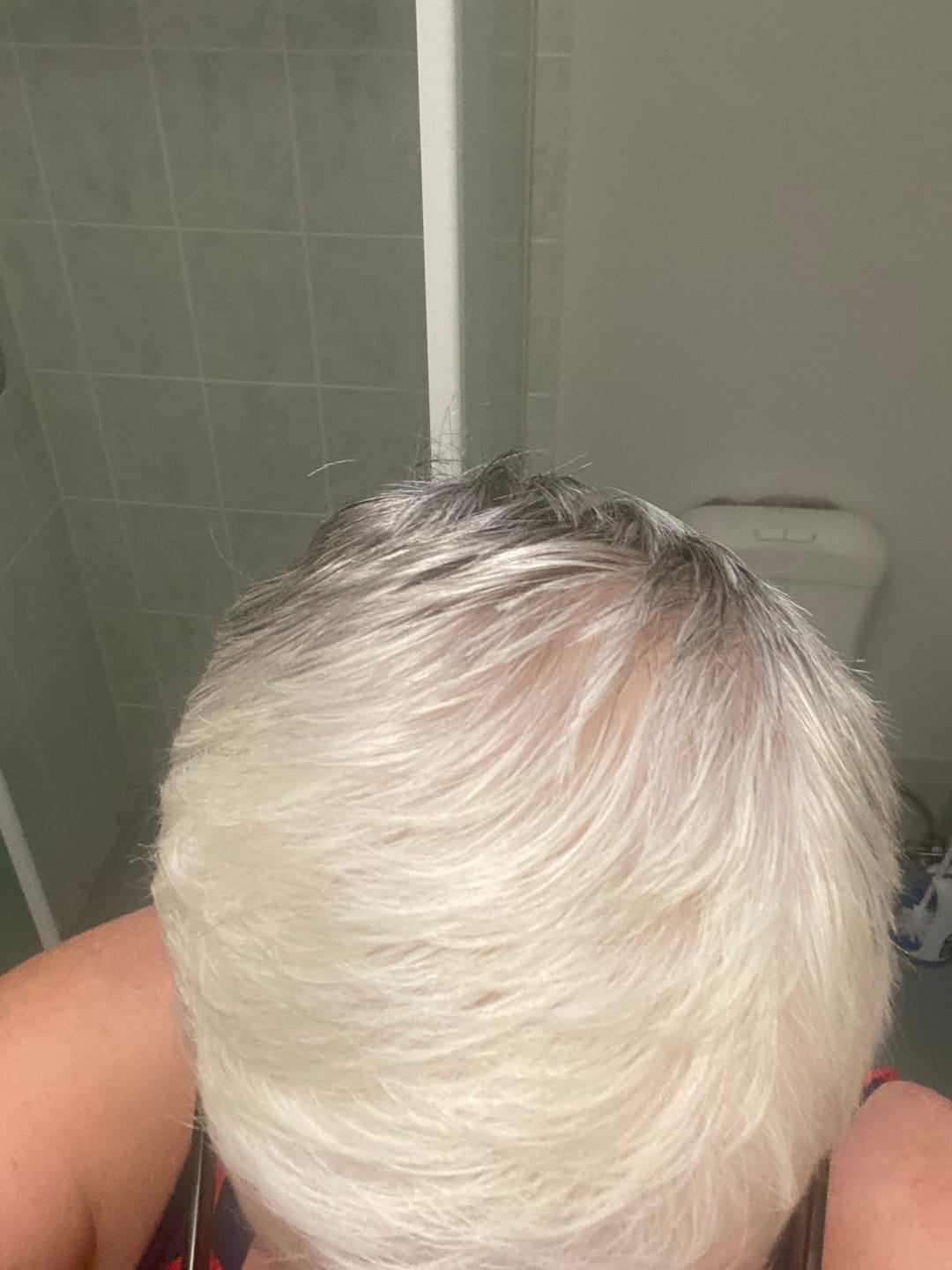 Customer photo review of PEPTIDE-POWERED HAIR SERUM