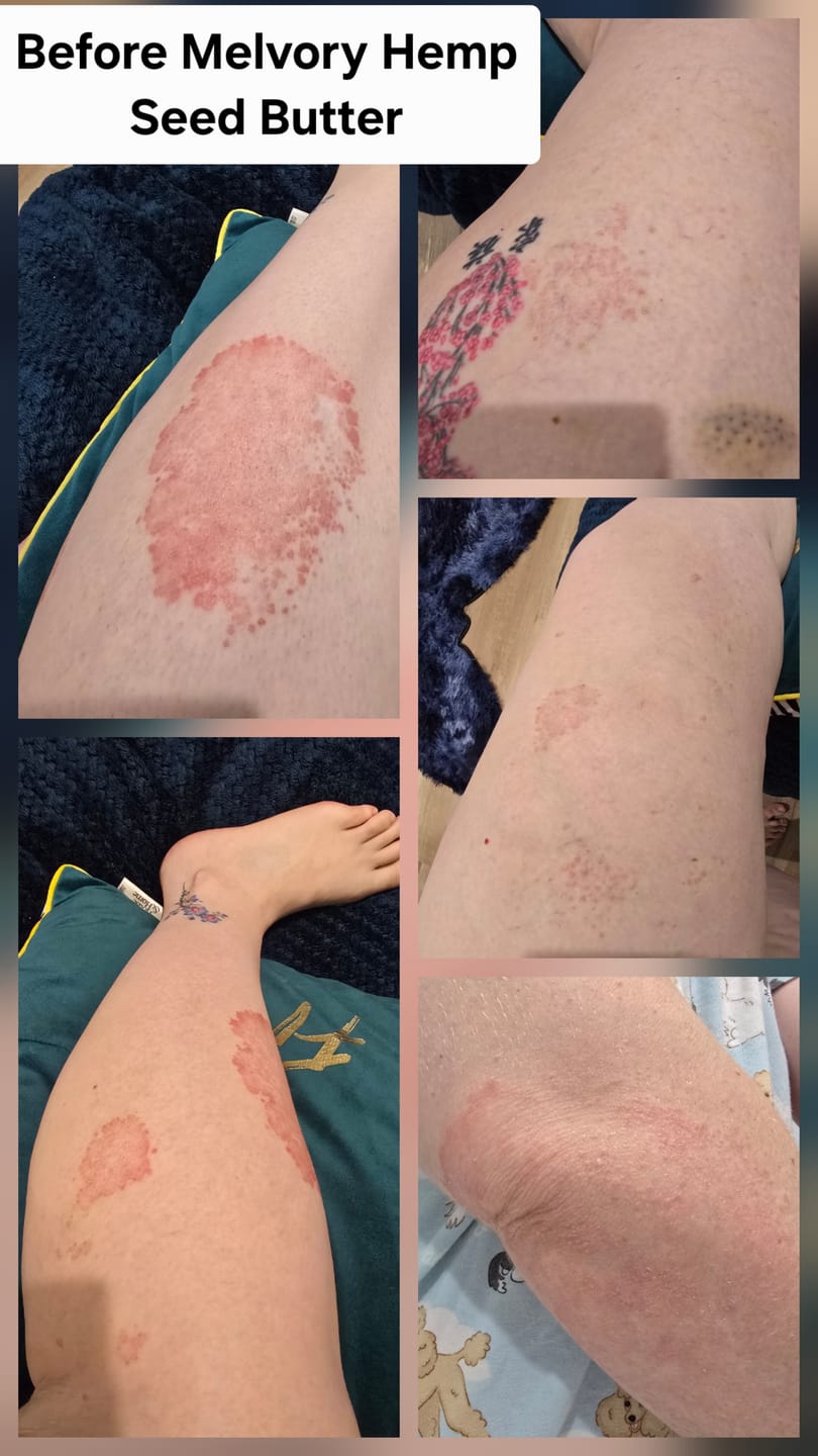 Customer photo review of Hemp Seed Rescue Butter