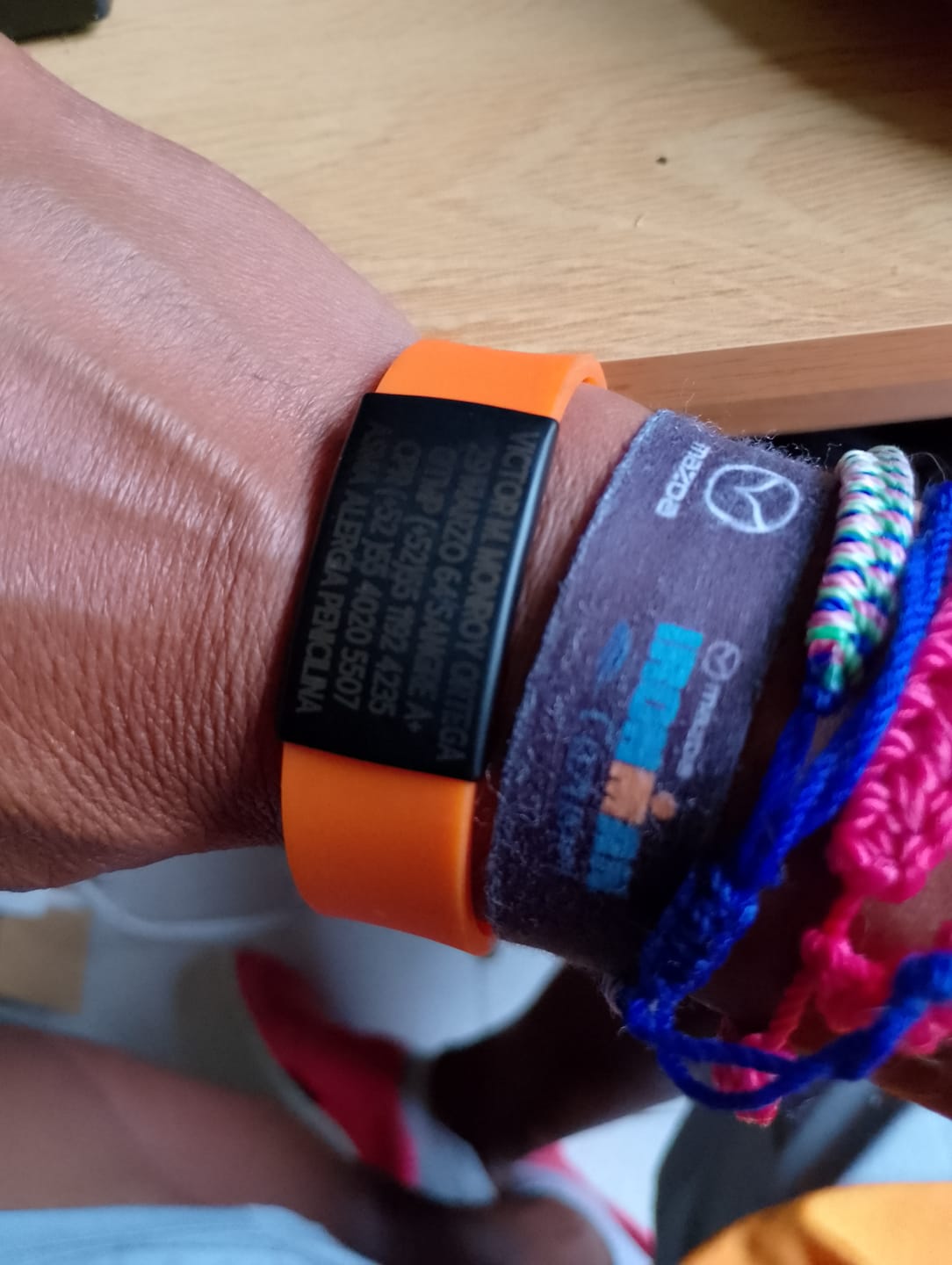 Customer photo review of Bandas Para AxoID