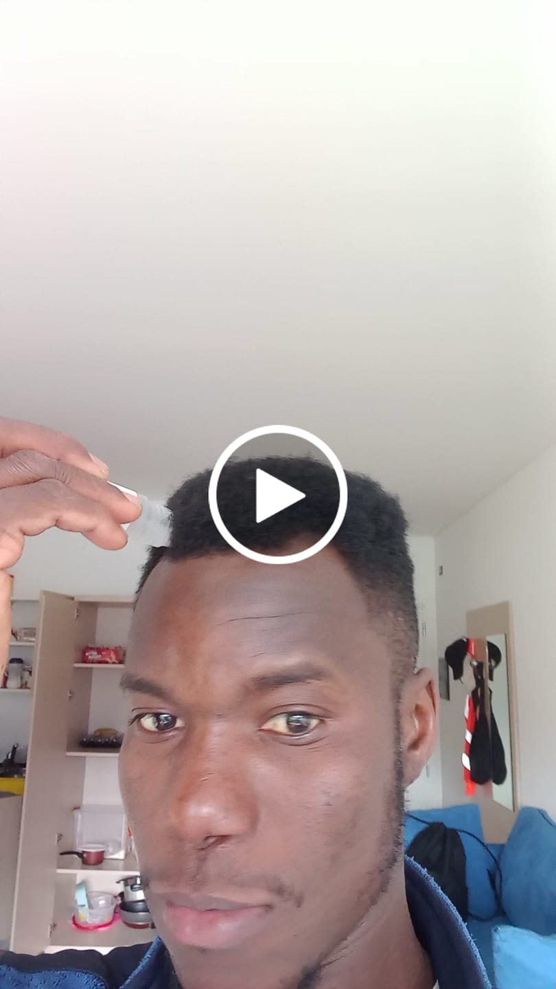 Customer video review of Patented Rosemary Hair Growth Roll-On Serum
