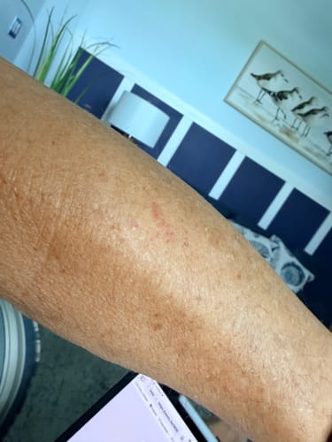Customer photo review of TryTallow™ Grass-Fed Tallow Balm (4oz)