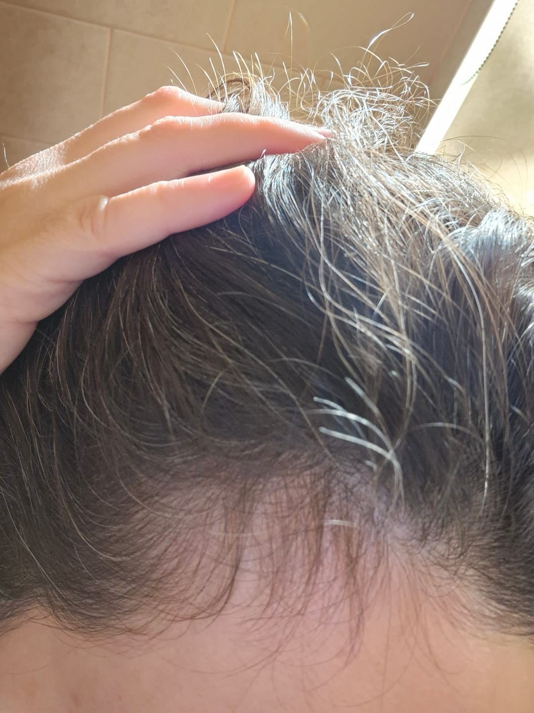 Customer photo review of Shampoo Anticaída + Acondicionador Provitamina B5