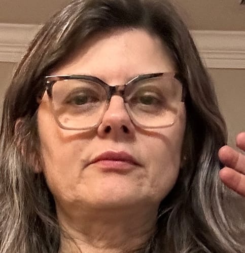 Reviewer's face before using the Seranova Micro Infusion System, showing visible wrinkles and skin texture.