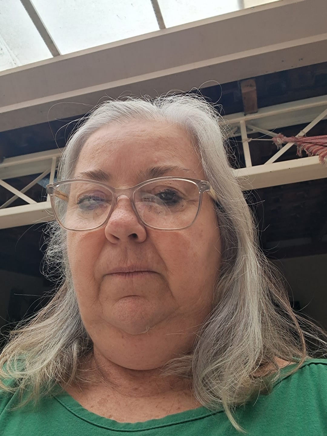 Customer photo review of Happy Hair 3 Potes + 1 Colágeno Grátis
