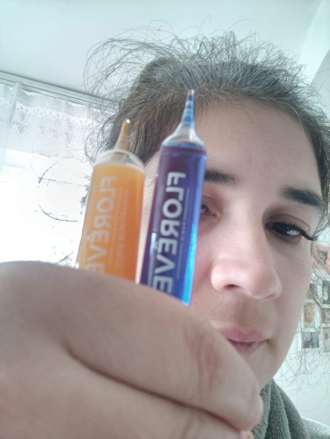 Customer photo review of [IN] Youth - Cure antichute cheveux