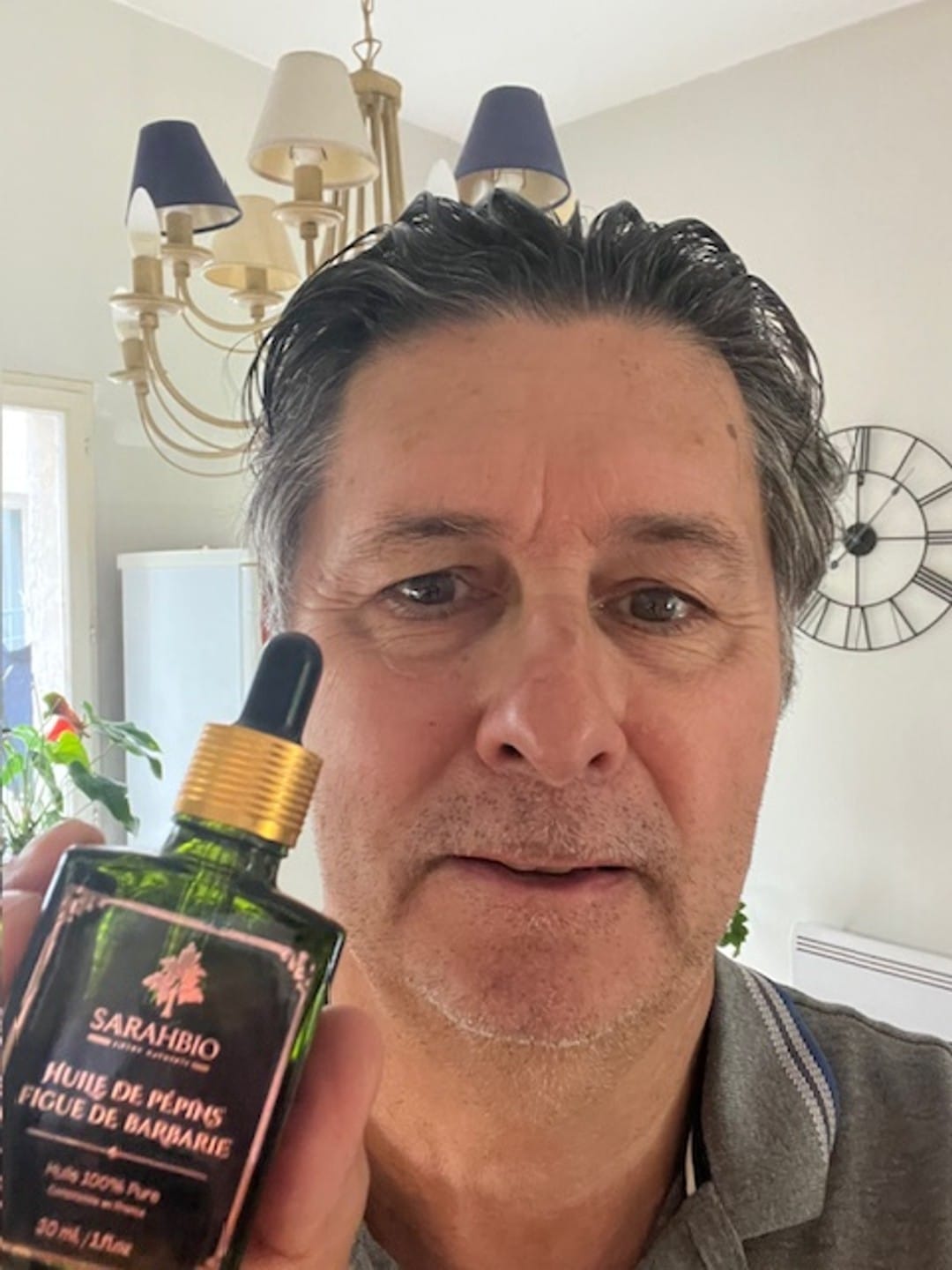 Customer photo review of Huile de pépins de figue de Barbarie Pure | 30 mL*