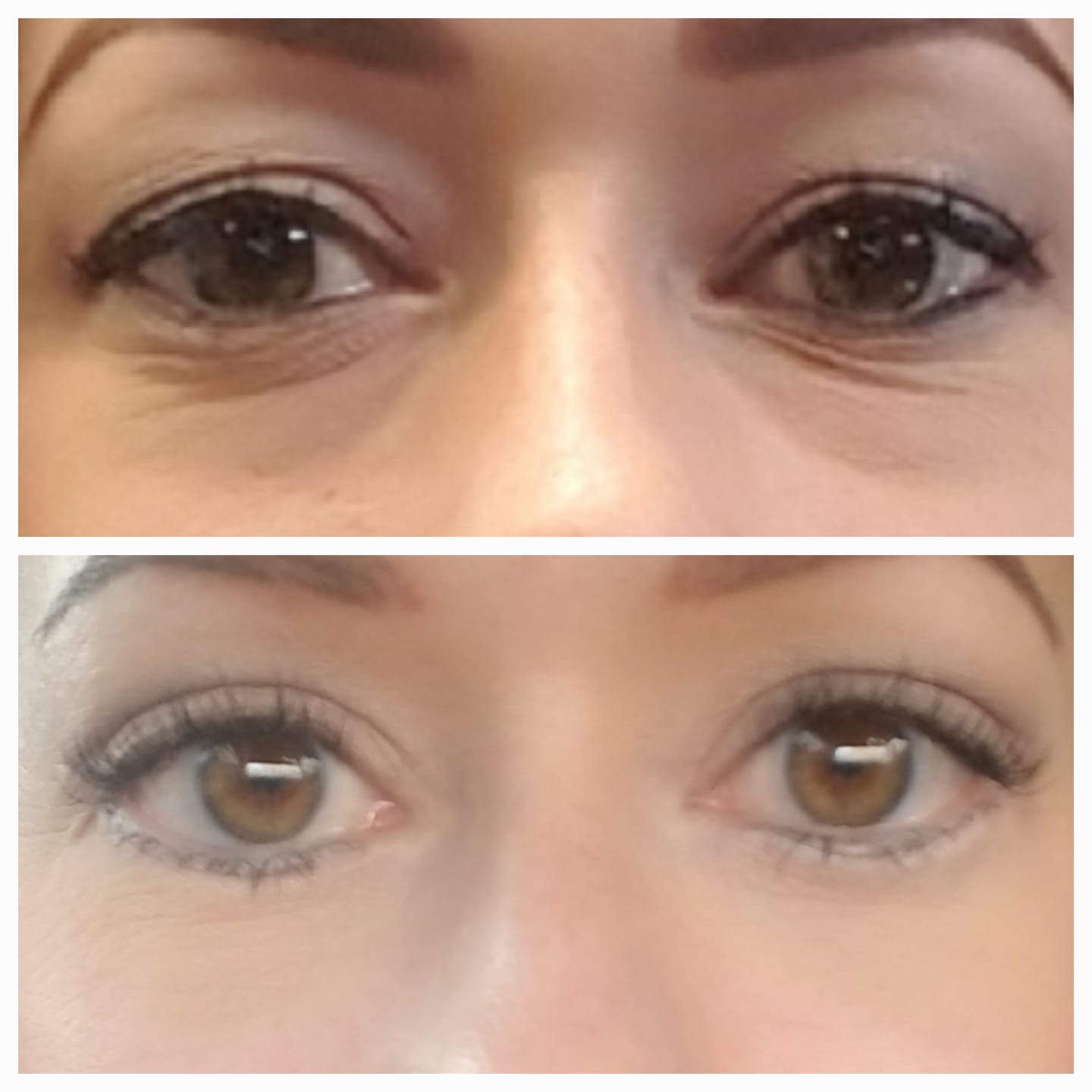 Customer photo review of Under Eye Skincare Wand