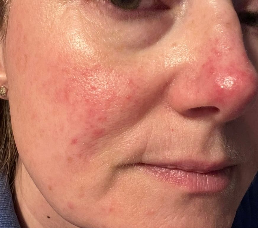 Customer photo review of Calm Balm