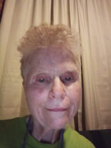 Customer photo review of Wendy's Drawing Salve