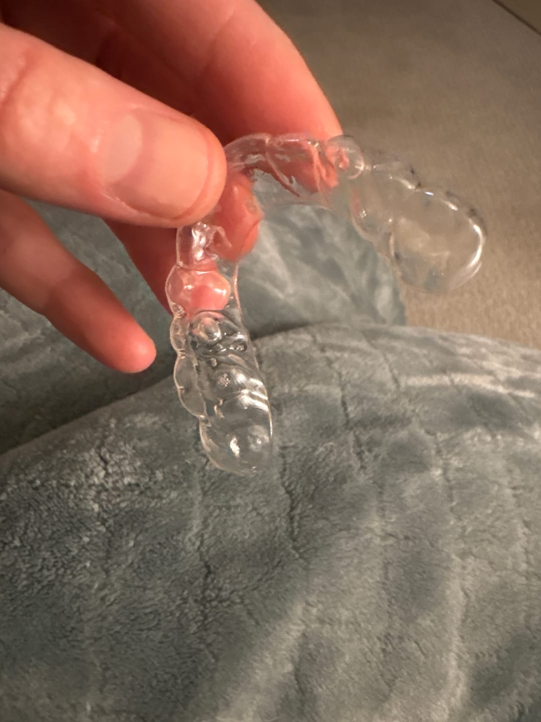 Customer photo review of Clear Custom Night Guard