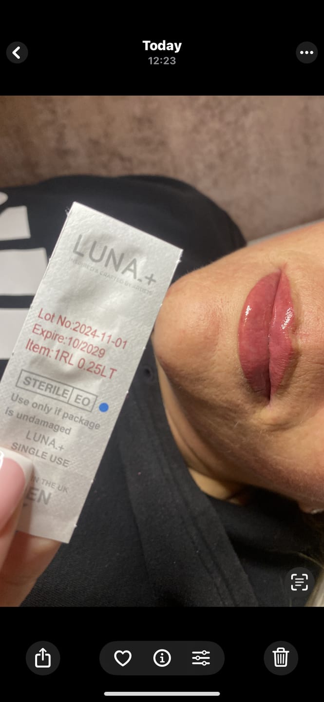 Customer photo review of Round Liner - Luna+ Cartridges - Box of 20