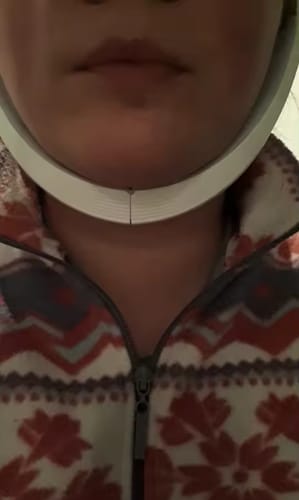Customer photo review of ALISSEA V-SCULPT™  Dispositivo lifting facial EMS- LED tecnology