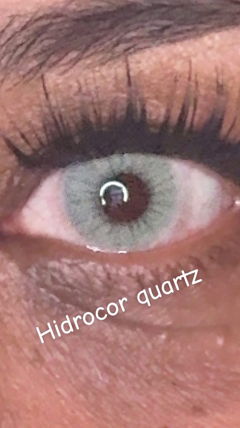 Customer photo review of Hidrocor Quartz Blue Gray Prescription Colored Contact Lenses
