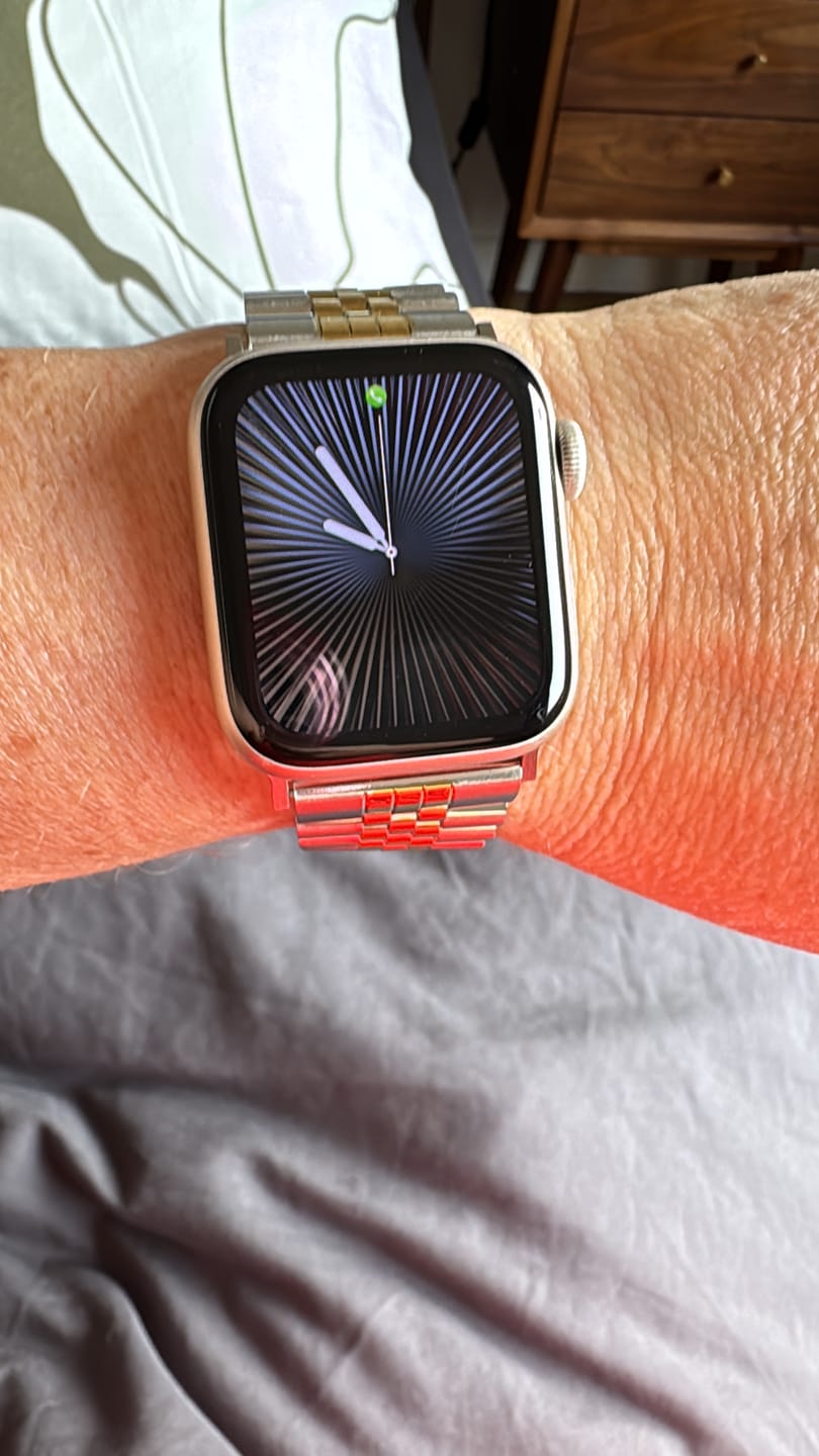 Customer photo review of Nete Stainless Band